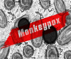Ce ar trebui sa stim despre variola maimutei?