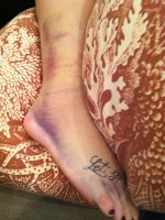 Demi Lovato si-a accidentat piciorul